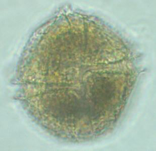 Loch Ness Dinoflagellate